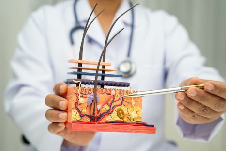 Foto: Arzt zeigt mit Kugelschreiber auf Modell von Haarwurzel